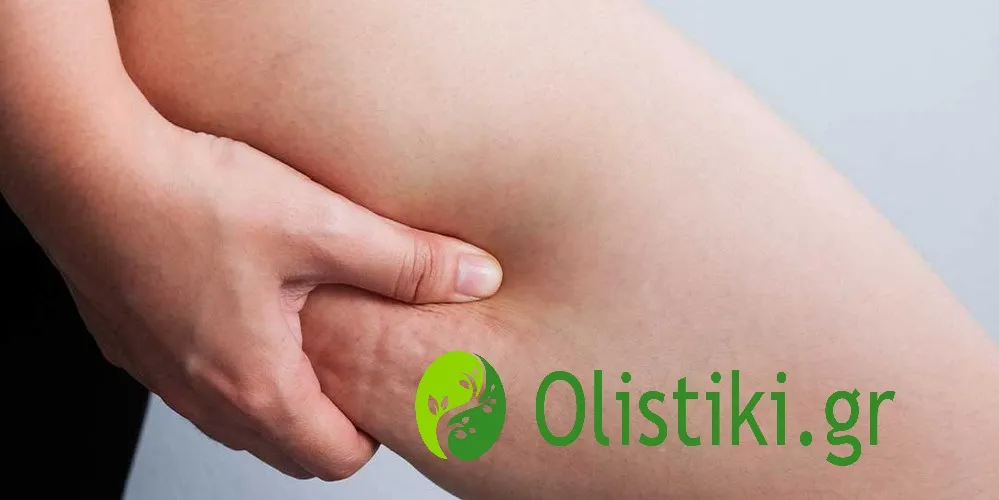 Τι προκαλεί την κυτταρίτιδα και πως μπορούμε να την αντιμετωπίσουμε